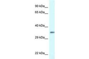Image no. 1 for anti-PDZ and LIM Domain 1 (PDLIM1) (AA 216-265) antibody (ABIN6747329) (PDLIM1 antibody  (AA 216-265))