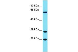 Host: Rabbit Target Name: FAM220A Sample Type: COLO205 Whole Cell lysates Antibody Dilution: 1. (Family with Sequence Similarity 220, Member A (FAM220A) (Middle Region) antibody)