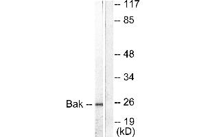 Western blot analysis of extracts from 293 cells, using Bak antibody (#C0131). (BAK1 antibody)