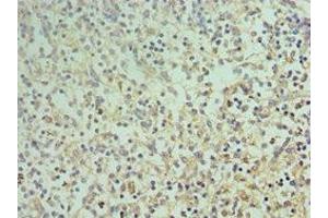 Immunohistochemistry of paraffin-embedded human spleen tissue using ABIN7158900 at dilution of 1:100 (CD68 antibody  (AA 22-319))