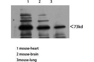 Western Blot (WB) analysis of Mouse Heart Mouse Brain Mouse Lung using Neuregulin-3 Polyclonal Antibody diluted at 1:800.