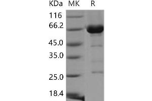 Western Blotting (WB) image for Cell Division Cycle 37 Homolog (S. Cerevisiae) (CDC37) protein (GST tag,His tag) (ABIN7320133) (CDC37 Protein (GST tag,His tag))