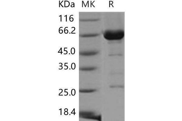 CDC37 Protein (GST tag,His tag)