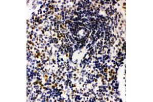 Anti-Nucleophosmin antibody, IHC(P) IHC(P): Rat Spleen Tissue (NPM1 antibody  (N-Term))