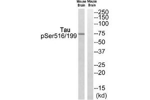 Western blot analysis of extracts from Mouse brain cells, using Tau (Phospho-Ser516/199) antibody. (MAPT antibody  (pSer199, pSer516))
