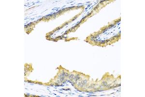 Immunohistochemistry of paraffin-embedded human prostate using PENK antibody (ABIN5973724) at dilution of 1/100 (40x lens). (Enkephalin antibody)