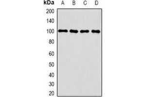 Western blot analysis of CLCN5 expression in HepG2 (A), THP1 (B), mouse kidney (C), mouse brain (D) whole cell lysates. (Chloride Channel 5 antibody)