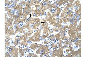 ACAT2 antibody was used for immunohistochemistry at a concentration of 4-8 ug/ml to stain Hepatocytes (arrows) in Human liver. (ACAT2 antibody)