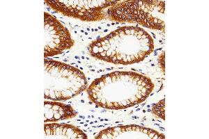 Paraformaldehyde-fixed, paraffin embedded human stomach tissue, Antigen retrieval by boiling in sodium citrate buffer (pH6. (Calpain 2 antibody)