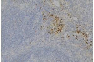 ABIN6277714 at 1/100 staining Human lymph node tissue by IHC-P.