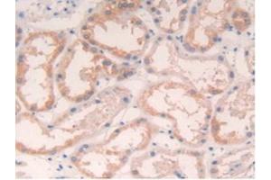 Detection of IL4 in Human Kidney Tissue using Polyclonal Antibody to Interleukin 4 (IL4) (IL-4 antibody  (AA 25-153))