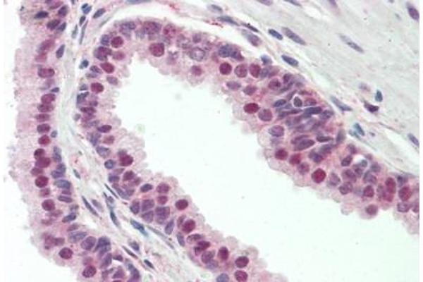 ZNF451 antibody  (C-Term)
