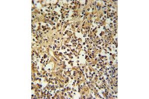GZ Antibody (Center) (ABIN390763 and ABIN2841021) IHC analysis in formalin fixed and paraffin embedded human lymph tissue followed by peroxidase conjugation of the secondary antibody and DAB staining. (GZMM antibody  (AA 84-113))