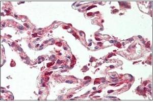 Human Lung: Formalin-Fixed, Paraffin-Embedded (FFPE) (TSC22D1 antibody  (N-Term))