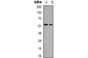 Western blot analysis of HNF4 alpha expression in HT29 (A), rat muscle (B) whole cell lysates. (HNF4A antibody)