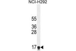 Western Blotting (WB) image for anti-Hepatocellular Carcinoma, Down-Regulated 1 (HEPN1) antibody (ABIN2995879)