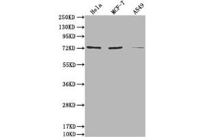 Western Blot Positive WB detected in: Hela whole cell lysate, MCF-7 whole cell lysate, A549 whole cell lysate All lanes: SAMHD1 antibody at 1:2000 Secondary Goat polyclonal to rabbit IgG at 1/50000 dilution Predicted band size: 73, 64, 69 kDa Observed band size: 73 kDa (SAMHD1 antibody  (AA 1-314))