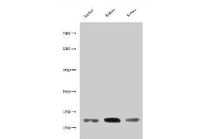 Western Blot Positive WB detected in: Jurkat whole cell lysate, Rat kidney tissue, Mouse kidney tissue All lanes: MIF antibody at 3 μg/mL Secondary Goat polyclonal to rabbit IgG at 1/50000 dilution Predicted band size: 13 kDa Observed band size: 13 kDa (MIF antibody  (AA 2-115))