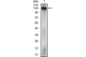 Fig. (MCAM antibody  (AA 84-189))