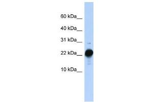 CSHL1 antibody used at 1 ug/ml to detect target protein. (CSHL1 antibody  (C-Term))