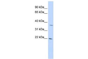 Western Blotting (WB) image for anti-DNA-Damage-Inducible Transcript 4-Like (DDIT4L) antibody (ABIN2459586)