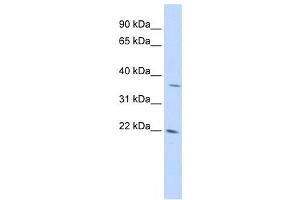 Western Blotting (WB) image for anti-DNA-Damage-Inducible Transcript 4-Like (DDIT4L) antibody (ABIN2459586) (DDIT4L antibody)