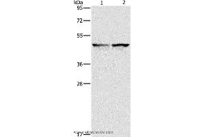 Western blot analysis of 231 and hela cell, using IDH1 Polyclonal Antibody at dilution of 1:550 (IDH1 antibody)