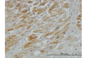 Image no. 5 for anti-Hedgehog Interacting Protein (HHIP) (AA 21-121) antibody (ABIN466235) (HHIP antibody  (AA 21-121))
