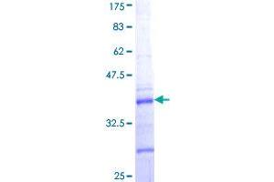 COL5A2 Protein (AA 41-124) (GST tag)