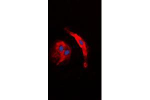 Immunofluorescent analysis of Collagen 5 alpha 3 staining in HuvEc cells. (COL5A3 antibody  (N-Term))