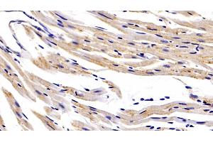 Immunohistochemistry (IHC) image for anti-Hypoxia Inducible Factor 1, alpha Subunit (Basic Helix-Loop-Helix Transcription Factor) (HIF1A) (AA 575-826) antibody (ABIN7432634)