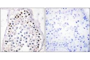Immunohistochemistry analysis of paraffin-embedded human testis tissue, using HOXA1/B1/D1 Antibody. (HOXA1/B1/D1 antibody  (AA 216-265))