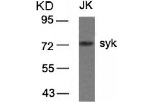 Image no. 3 for anti-Spleen tyrosine Kinase (SYK) (AA 321-325) antibody (ABIN319415) (SYK antibody  (AA 321-325))