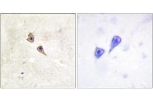 Immunohistochemistry analysis of paraffin-embedded human brain, using Interferon-alpha/beta Receptor alpha (Phospho-Tyr466) Antibody. (IFN-alpha/beta R1 (AA 436-485), (pTyr466) antibody)