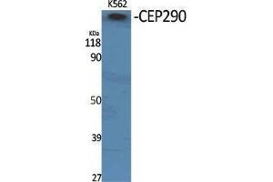 Western Blotting (WB) image for anti-Centrosomal Protein 290kDa (CEP290) (Internal Region) antibody (ABIN3183860)