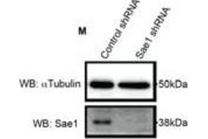 Western Blotting (WB) image for anti-SUMO1 Activating Enzyme Subunit 1 (SAE1) antibody (ABIN2856922)