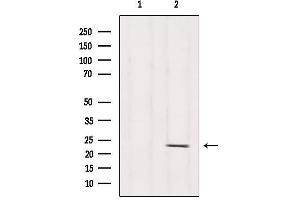 Western blot analysis of extracts from Hela, using RPS5 Antibody. (RPS5 antibody  (Internal Region))