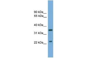 WB Suggested Anti-WIF1 Antibody Titration: 0.