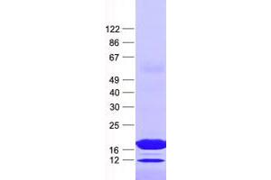 Validation with Western Blot (NUDT6 Protein (His tag))