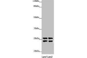 Western blot All lanes: GRPEL1 antibody at 2. (GRPEL1 antibody  (AA 1-217))