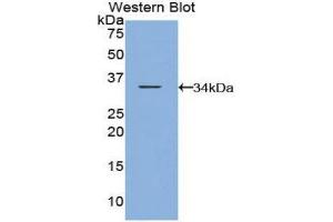 Western Blotting (WB) image for anti-Caspase Recruitment Domain Family, Member 9 (CARD9) (AA 274-530) antibody (ABIN1858233)