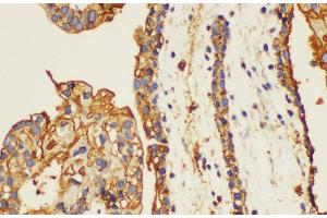 Immunohistochemistry of paraffin-embedded Human placenta using ANXA5 Ployclonal Antibody at dilution of 1:100. (Annexin V antibody)