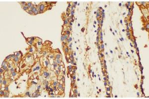 Immunohistochemistry of paraffin-embedded Human placenta using ANXA5 Ployclonal Antibody at dilution of 1:100.