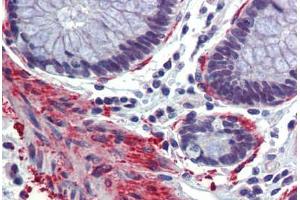 Colon, Human: Formalin-Fixed, Paraffin-Embedded (FFPE) (CBP antibody  (AA 144-193))