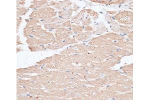 Immunohistochemistry of paraffin-embedded Rat heart using ABCC5 Polyclonal Antibody at dilution of 1:100 (40x lens). (ABCC5 antibody)