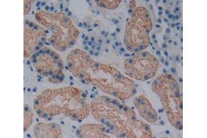 Used in DAB staining on fromalin fixed paraffin- embedded kidney tissue (ABCB6 antibody  (AA 590-842))