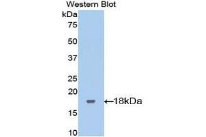 Western Blotting (WB) image for anti-Leukemia Inhibitory Factor Receptor alpha (LIFR) (AA 151-290) antibody (ABIN3208379) (LIFR antibody  (AA 151-290))