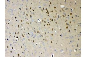 IHC testing of FFPE mouse brain tissue with NDRG3 antibody at 1ug/ml.