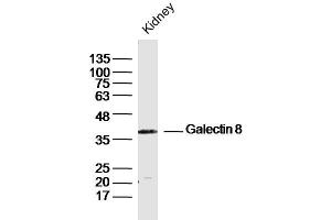 Mouse Kidney lysates probed with Galectin 8 Polyclonal Antibody, Unconjugated  at 1:300 dilution and 4˚C overnight incubation. (LGALS8 antibody  (AA 281-359))
