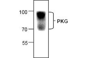 Image no. 1 for anti-Protein Kinase, CGMP-Dependent, Type I (PRKG1) (N-Term) antibody (ABIN127130) (PRKG1 antibody  (N-Term))